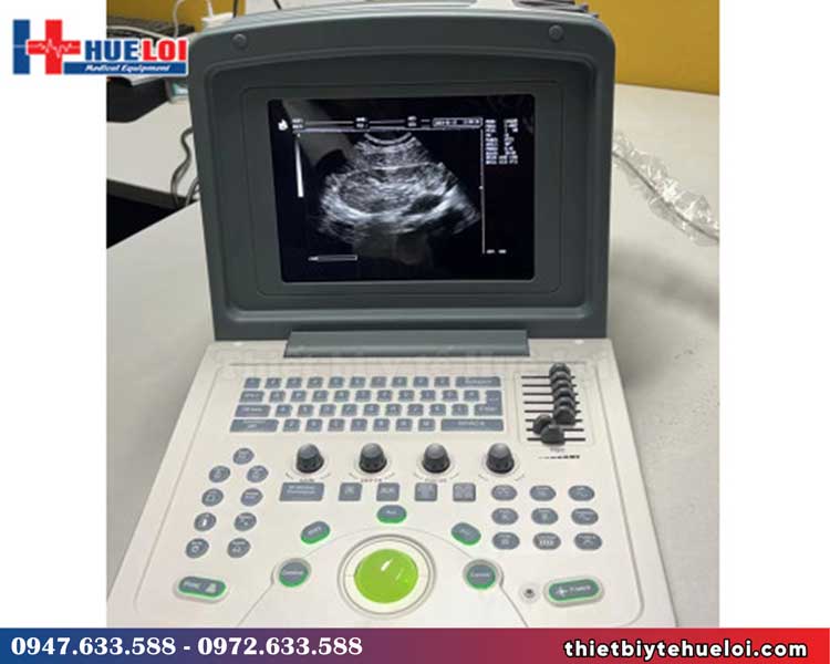 Máy siêu âm thú y giá rẻ WED-9618V